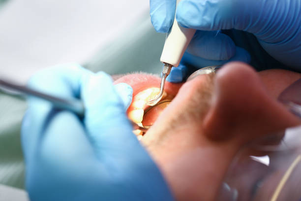 Best Walk-In Emergency Dental Services in Moraine, OH