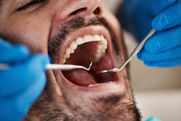 Best Emergency Denture Repair in Moraine, OH